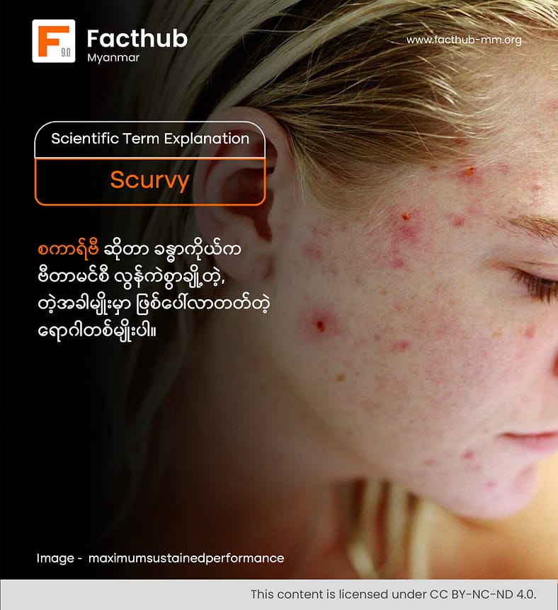 Scurvy ဆိုတဲ့ စကားလုံးကို သိပါသလား . . . ?